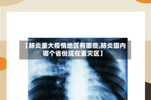 【肺炎重大疫情地区有哪些,肺炎国内哪个省份现在重灾区】