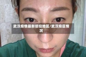 武汉疫情最新管控地区/武汉疫区情况