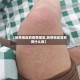 【热带地区的疫情爆发,热带地区容易得什么病】