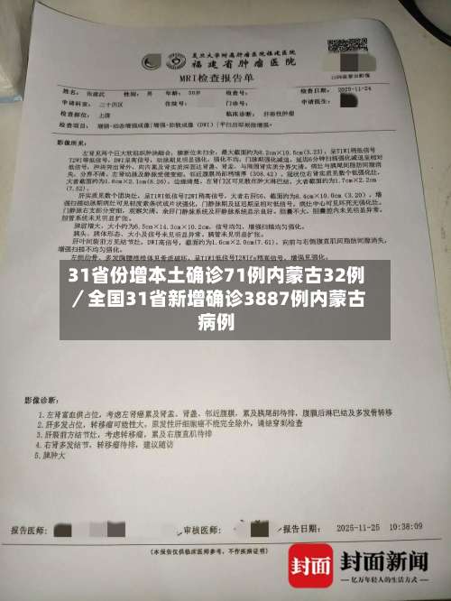31省份增本土确诊71例内蒙古32例／全国31省新增确诊3887例内蒙古病例-第1张图片