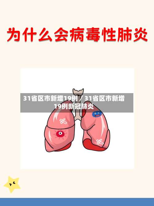 31省区市新增19例／31省区市新增19例新冠肺炎-第1张图片