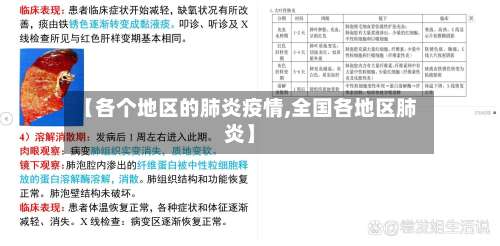 【各个地区的肺炎疫情,全国各地区肺炎】-第1张图片