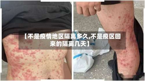 【不是疫情地区隔离多久,不是疫区回来的隔离几天】-第2张图片