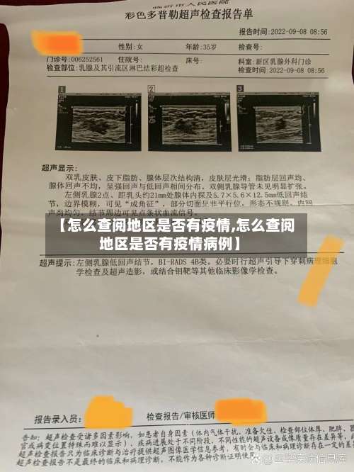 【怎么查阅地区是否有疫情,怎么查阅地区是否有疫情病例】-第1张图片